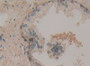 DAB staining on IHC-P; Samples: Human Prostate Gland Tissue