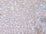 DAB staining on IHC-P; Samples: Human Liver Tissue