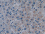 DAB staining on IHC-P Samples: Human Liver Tissue)