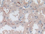 DAB staining on IHC-P; Samples: Human Kidney Tissue
