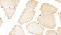 DAB staining on IHC-P; Samples: Human Skeletal muscle Tissue; Primary Ab: 20μg/ml Rabbit Anti-Human IL1b Antibody Second Ab: 2µg/mL HRP-Linked Caprine Anti-Rabbit IgG Polyclonal Antibody