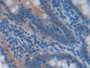 DAB staining on IHC-P; Samples: Rat Small intestine Tissue; Primary Ab: 30µg/ml Rabbit Anti-Rat NOX1 Antibody Second Ab: 2µg/mL HRP-Linked Caprine Anti-Rabbit IgG Polyclonal Antibody