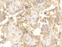 DABstainingonIHC-P.Samples:HumanTissue)