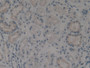 DAB staining on IHC-P; Samples: Human Kidney Tissue;  Primary Ab: 10µg/ml Rabbit Anti-Human KRT15 An