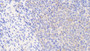 DAB staining on IHC-P. Samples: Human Tissue)