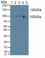 Western Blot; Sample: Lane1: Human Hela Cells; Lane2: Human Jurkat Cells; Lane3: Human HepG2 Cells; Lane4: Human U2OS Cells; Lane5: Human A549 Cells.