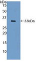 Western Blot; Sample: Recombinant KRT5, Mouse.