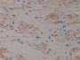 DAB staining on IHC-P; Samples: Human Prostate Gland Tissue