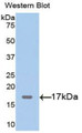 Western Blot; Sample: Recombinant protein.