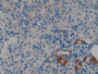 DAB staining on fromalin fixed paraffin- embedded kidney tissue)