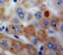 Used in DAB staining on fromalin fixed paraffin-embedded Liver tissue