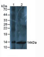 Western Blot; Sample: Lane1: Mouse Liver Tissue; Lane2: Mouse Spinal Cord Tissue.