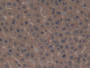 DAB staining on fromalin fixed paraffin- embedded stomach tissue) DAB staining on fromalin fixed paraffin- embedded stomach tissue)