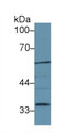 Western Blot; Sample: Mouse Liver lysate; Primary Ab: 1µg/ml Rabbit Anti-Mouse LIPG Antibody Second Ab: 0.2µg/mL HRP-Linked Caprine Anti-Rabbit IgG Polyclonal Antibody Western Blot; Sample: Mouse Liver lysate; Primary Ab: 1µg/ml Rabbit Anti-Mouse LIPG Antibody Second Ab: 0.2µg/mL HRP-Linked Caprine Anti-Rabbit IgG Polyclonal Antibody