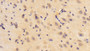 DAB staining on IHC-P; Samples: Rat Cerebrum Tissue; Primary Ab: 10μg/ml Rabbit Anti-Rat PKCg Antibody Second Ab: 2µg/mL HRP-Linked Caprine Anti-Rabbit IgG Polyclonal Antibody
