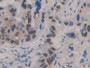DAB staining on fromalin fixed paraffin- embedded stomach tissue)