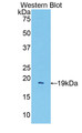 Western Blot; Sample: Recombinant protein.
