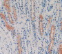 Used in DAB staining on fromalin fixed paraffin- embedded Kidney tissue