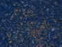 DAB staining on IHC-P; Samples: Mouse Lymph node Tissue; Primary Ab: 20µg/ml Rabbit Anti-Mouse COL1a1 Antibody Second Ab: 2µg/mL HRP-Linked Caprine Anti-Rabbit IgG Polyclonal Antibody