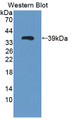 Western Blot; Sample: Recombinant protein.