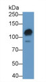 Western Blot; Sample: K562 cell lysate; Primary Ab: 1μg/ml Rabbit Anti-Human PARP Antibody; Second Ab: 0.2µg/mL HRP-Linked Caprine Anti-Rabbit IgG Polyclonal Antibody;