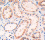 Talin 1 (TLN1) Polyclonal Antibody, Cat#CAU28206