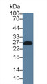 Western Blot; Sample: Human Jurkat cell lysate; Primary Ab: 3µg/ml Rabbit Anti-Rat LAT Antibody Second Ab: 0.2µg/mL HRP-Linked Caprine Anti-Rabbit IgG Polyclonal Antibody
