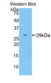 Western Blot; Sample: Recombinant protein.