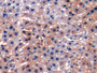 DAB staining on IHC-P; Samples: Rat Liver Tissue;  Primary Ab: 10µg/ml Rabbit Anti-Rat ALT Antibody 