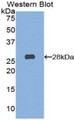 Western Blot; Sample: Recombinant protein.