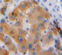 Used in DAB staining on fromalin fixed paraffin-embedded Liver tissue