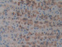 DAB staining on fromalin fixed paraffin- embedded Kidney tissue)