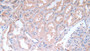 DAB staining on IHC-P; Samples: Human Kidney Tissue;  Primary Ab: 30µg/ml Rabbit Anti-Human aHSG Antibody Second Ab: 2µg/mL HRP-Linked Caprine Anti-Rabbit IgG Polyclonal Antibody 