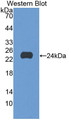 Western Blot; Sample: Recombinant protein.