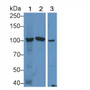 Western Blot; Sample: Lane1: Mouse Liver lysate; Lane2: Mouse Placenta lysate; Lane3: Human 293T cell lysate; Primary Ab: 1µg/ml Rabbit Anti-Mouse GaA Antibody; Second Ab: 0.2µg/mL HRP-Linked Caprine Anti-Rabbit IgG Polyclonal Antibody;