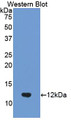 Western Blot; Sample: Recombinant protein.