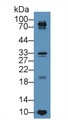 Western Blot; Sample: Human BXPC3 cell lysate; Primary Ab: 5µg/ml Rabbit Anti-Porcine TIMP4 Antibody Second Ab: 0.2µg/mL HRP-Linked Caprine Anti-Rabbit IgG Polyclonal Antibody