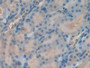 DAB staining on IHC-P; Samples: Rat Kidney Tissue)