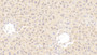 DAB staining on fromalin fixed paraffin-embedded Lung tissue)