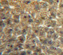 Used in DAB staining on fromalin fixed paraffin-embedded Liver tissue
