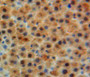 DAB staining on fromalin fixed paraffin-embedded liver tissue)