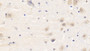 DAB staining on IHC-P; Samples: Human Cerebrum Tissue; Primary Ab: 20μg/ml Rabbit Anti-Human LEP Antibody Second Ab: 2µg/mL HRP-Linked Caprine Anti-Rabbit IgG Polyclonal Antibody
