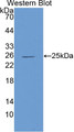 Western Blot; Sample: Recombinant protein.