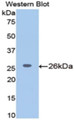 Western Blot; Sample: Recombinant protein.