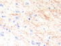 DAB staining on IHC-P; Samples: Human Brain Tissue