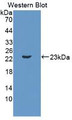Western Blot ;Sample: Recombinant IL11, Mouse.