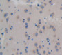 Colony Stimulating Factor 3, Granulocyte (GCSF) Polyclonal Antibody, Cat#CAU28878
