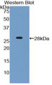 Western Blot; Sample: Recombinant protein.