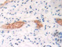 DAB staining on IHC-P; Samples: Human Stomach Tissue; Primary Ab: 10µg/ml Rabbit Anti-Human CX3CL1 Antibody Second Ab: 2µg/mL HRP-Linked Caprine Anti-Rabbit IgG Polyclonal Antibody