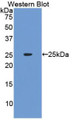 Western Blot; Sample: Recombinant protein.